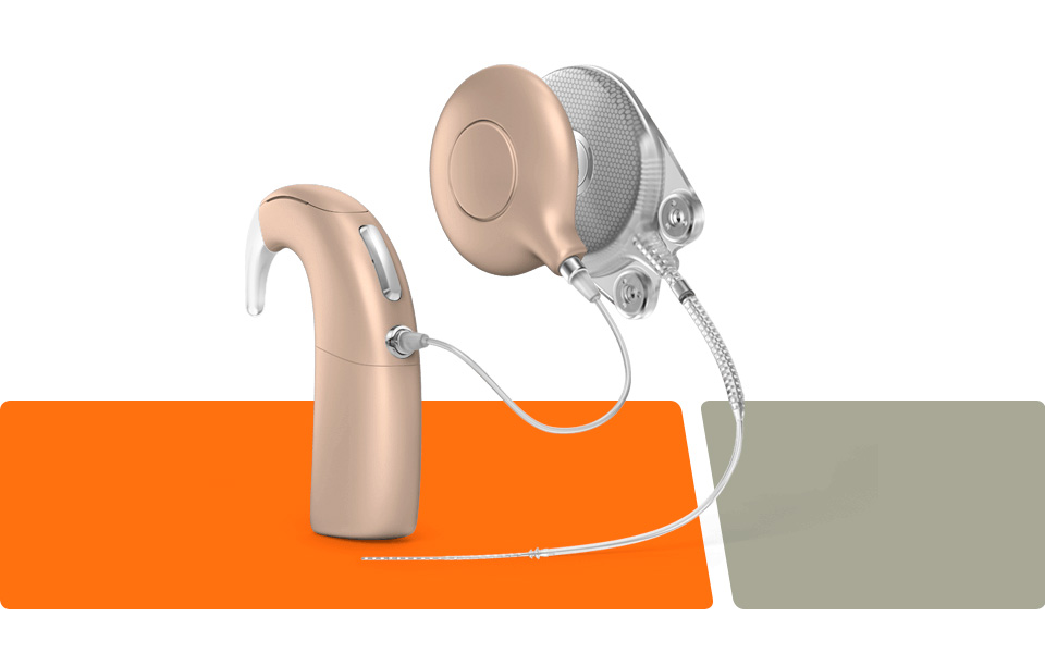 cochlear implant